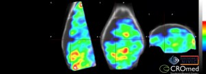CROmed imaging 4